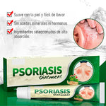 Crema Antifúngica y Antipicazón – Tratamiento Natural para Tiña, Hongos y Psoriasis