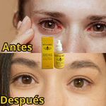 OFTALMIEL🐝Vuelve a sentir tus ojos frescos, hidratados y libres de molestias.
