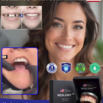 PROTESKIT™ – Prótesis Dental Completa con Soporte Esquelético (Sonrisa Firme y Natural)